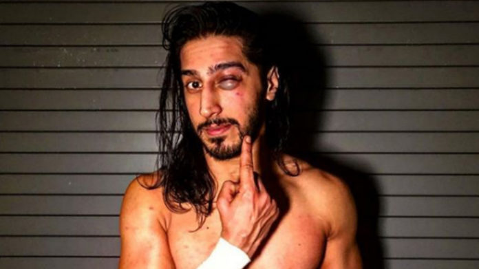 mustafa ali black eye 