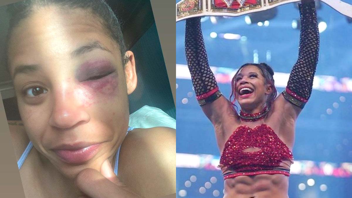 Bianca Belair Eye Injury