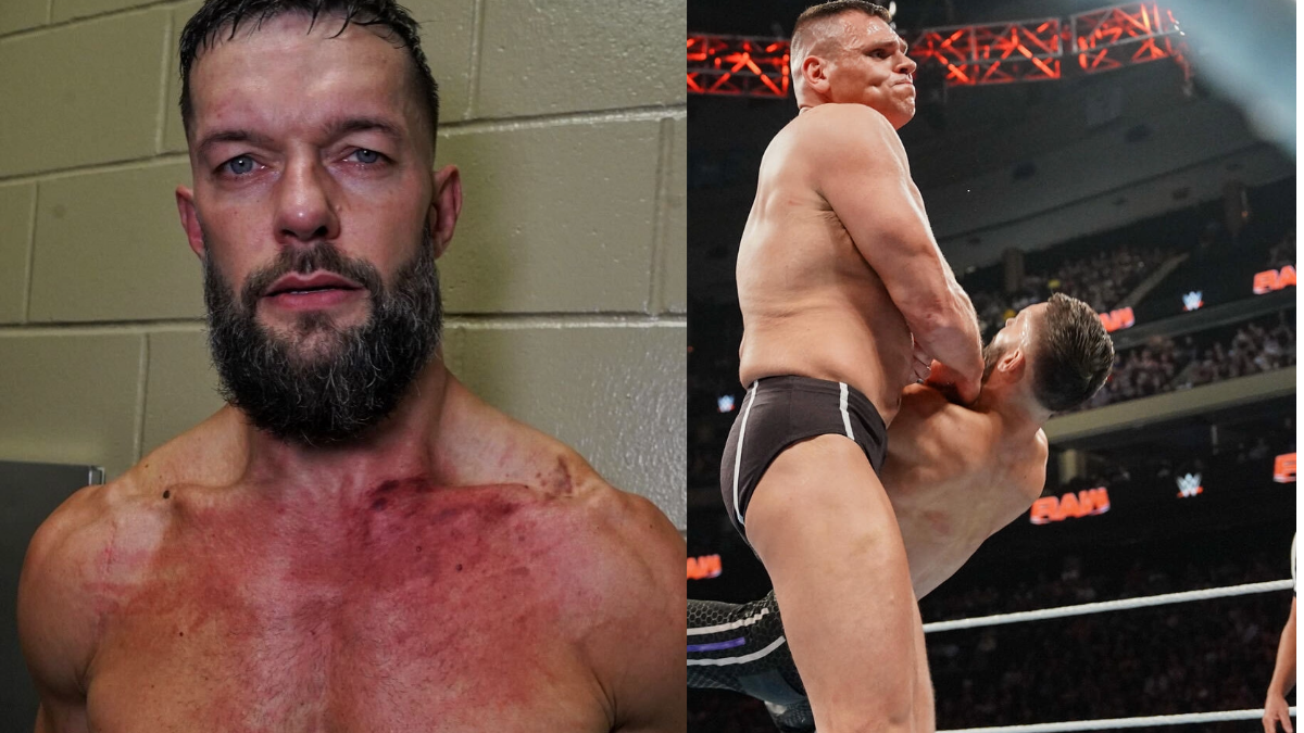 Finn Balor Shows Off Bruises After Facing Gunther On Raw