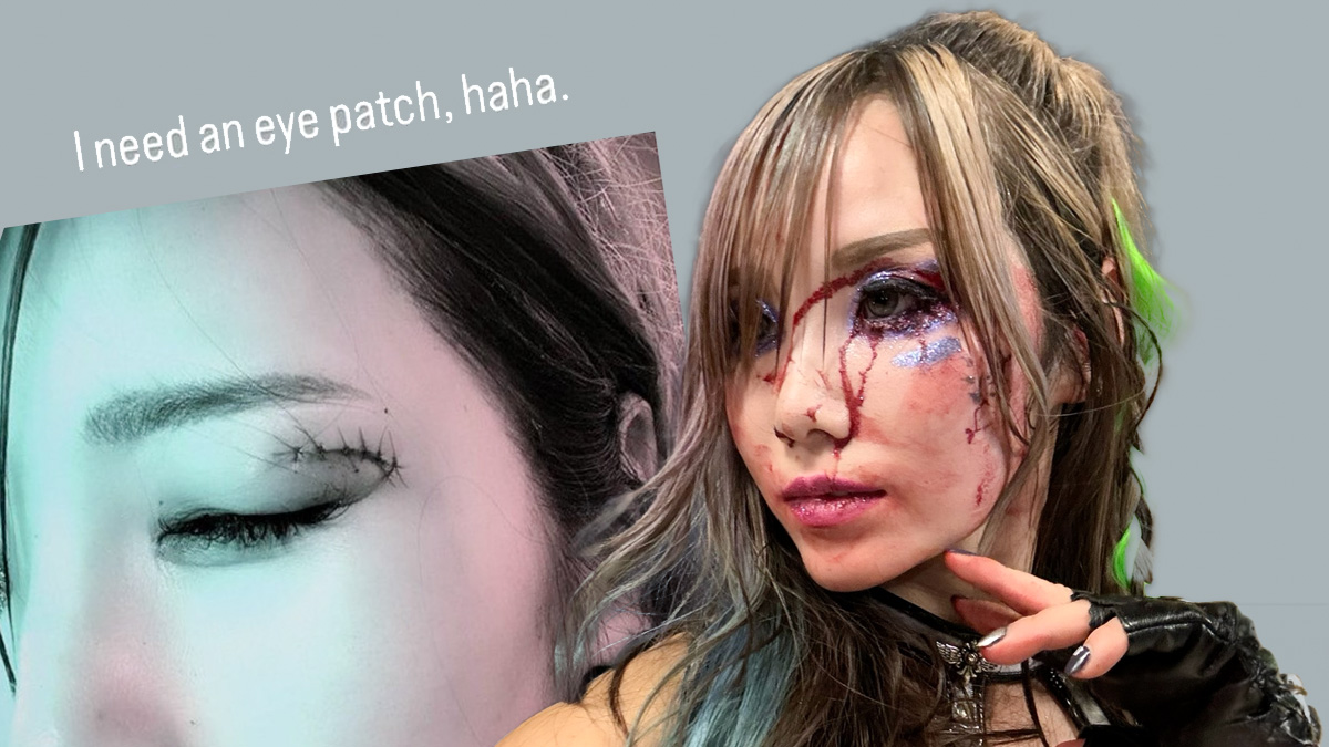 Kairi Sane Shows Off Stitches After Gruesome Eye Injury on Raw