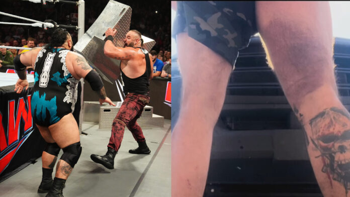 braun strowman injury