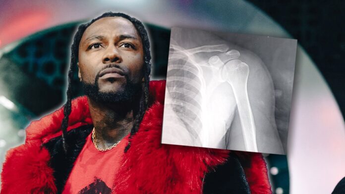 Swerve Strickland Shoulder X-Ray